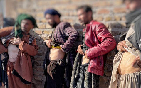 Người dân Afghanistan bán thận, tính bán con vì túng quẫn