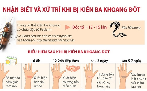 Nhận biết và xử trí khi bị kiến ba khoang đốt