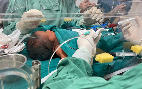 Hải Phòng: Bé sơ sinh 3 ngày tuổi được 'thay máu'