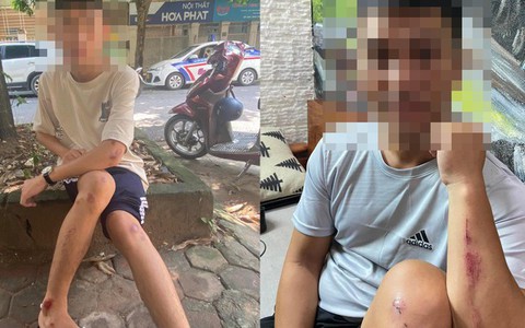Hà Nội: Truy tìm nhóm "tóc xanh, tóc đỏ" vô cớ dùng vỏ chai bia tấn công người đi đường