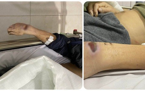 Hai cựu công an dùng nhục hình thế nào khiến người bị tạm giam tử vong?