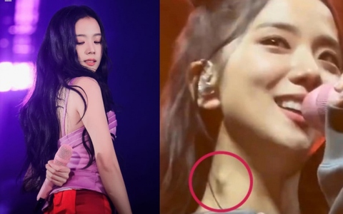 Công ty chủ quản chính thức phản hồi về sức khỏe của Jisoo (BLACKPINK)