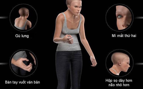 Nghiên cứu mới: Con người sẽ 'biến dạng' đáng sợ vì smartphone, laptop