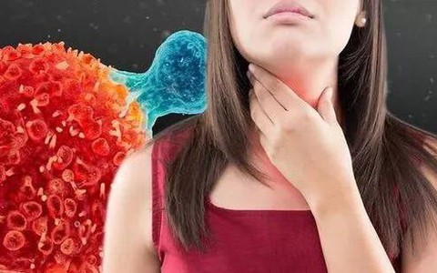 Triệu chứng đầu tiên xuất hiện khi bị ung thư thực quản