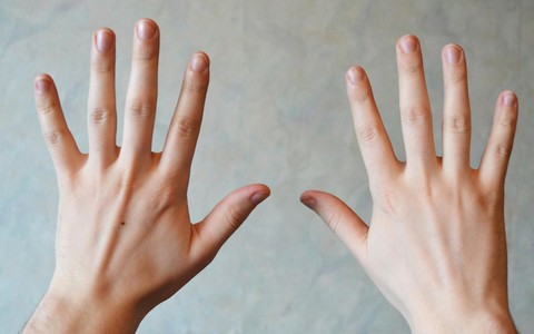 7 dấu hiệu ở tay cảnh báo sức khoẻ có vấn đề, từ viêm khớp đến thiếu chất, giảm tuổi thọ