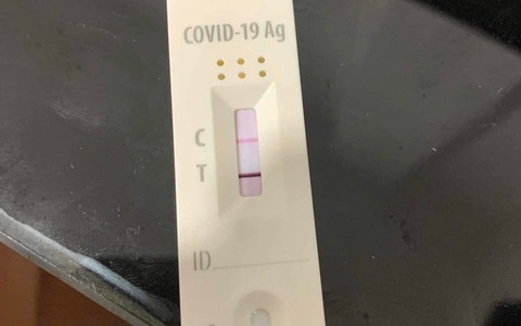 Nhiều trường hợp tái nhiễm Covid-19 sau 1-2 tháng khỏi bệnh: BS chỉ rõ lý do, nhắc nhở điều quan trọng nhất cần nhớ trong mùa dịch