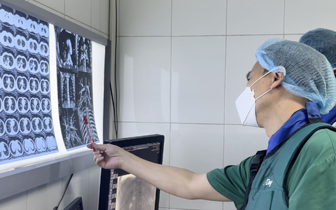 Mắc COVID-19, nam thanh niên ho ra máu ồ ạt