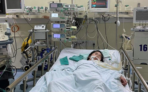 Tiền sử khoẻ mạnh, bé gái 12 tuổi mắc COVID-19 ho ra máu, phải đặt ECMO