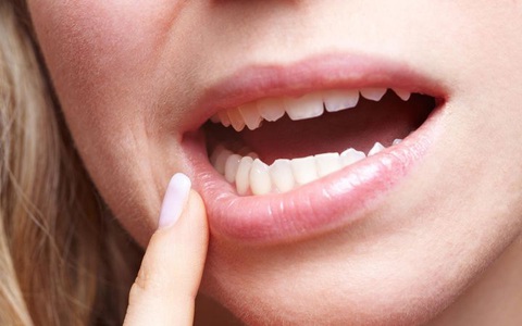 Dù bạn mới 25 hay 30 tuổi nhưng cơ thể xuất hiện "3 chảy xệ, 2 to và 1 đau" cảnh báo lão hóa nặng