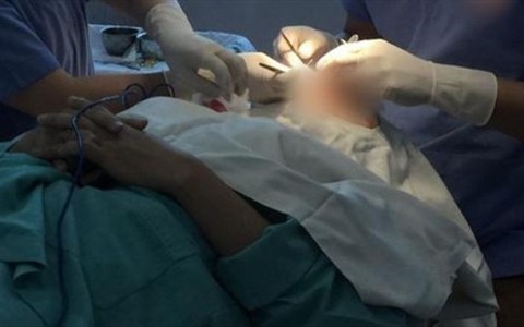 Báo động tai biến do thẩm mỹ