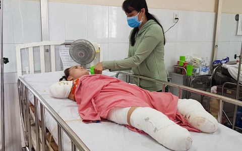 Người phụ nữ mất cả tứ chi vì điện giật khi dùng cây sắt hái xoài cho con