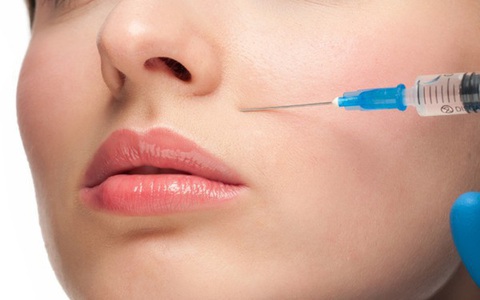 Cảnh báo: Mất thị lực sau tiêm filler làm đầy rãnh má tại tiệm tóc