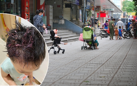 Hà Nội: Bé trai bị "vật thể lạ" rơi trúng đầu khi đi bộ dưới sân chung cư, công an vào cuộc điều tra