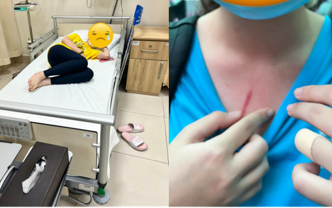 Phụ huynh tố con bị bạn học đánh ở trường quốc tế nổi tiếng TP.HCM: "Trước khi đánh con tôi, bé kia nhiều lần gây sự"
