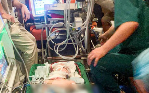 Vượt gần 700km, đặt ECMO cứu bé trai bị sốc phản vệ, phù phổi cấp, suy tuần hoàn
