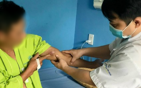 Người đàn ông tự kéo ra 2 con giun rồng từ các khối sưng nề trên cơ thể