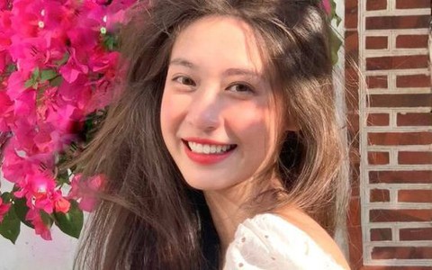 Tiêm filler rãnh cười: Tiểu phẫu lành tính, giúp nụ cười thêm xinh nhưng phải nhớ những việc "cấm kỵ" để chống lão hóa hiệu quả