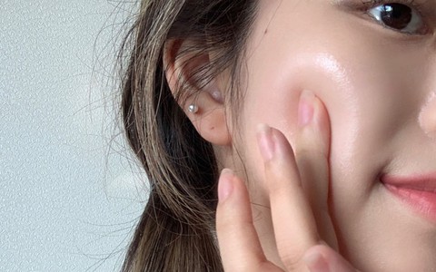 Lưu ý quan trọng khi trị nám da bằng laser