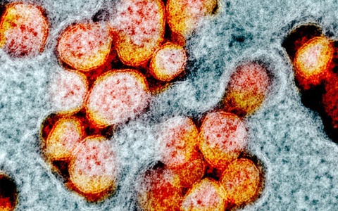 COVID-19 làm tăng chất béo cho các tế bào của cơ thể, thúc đẩy quá trình xâm nhập của virus