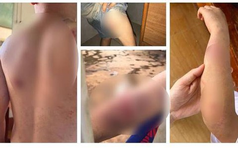 Bị tố đánh con trai 9 tuổi dã man, người bố nói gì?