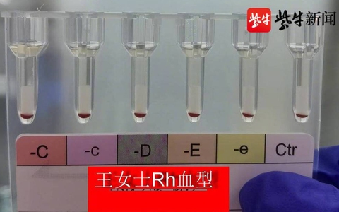Trung Quốc phát hiện 2 người có ‘nhóm máu vàng' hiếm nhất Trái Đất