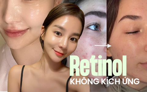 Thành phần giúp làm dịu kích ứng khi dùng Retinol
