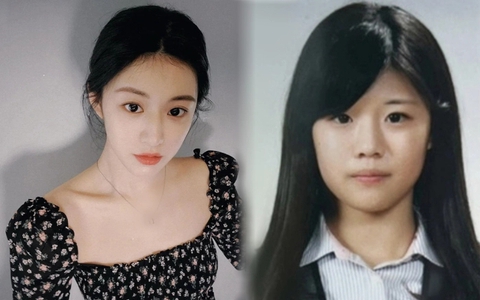 Netizen bênh vực Go Yoon Jung trước cáo buộc thẩm mỹ cả mặt