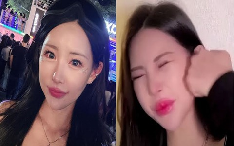Từng thừa nhận can thiệp thẩm mỹ, nữ YouTuber vẫn tự tay "tác động vật lý" cực mạnh vào "mặt tiền" vì một điều