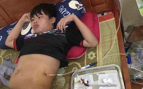 Hoàn cảnh đáng thương của nam sinh lớp 9 xin ra viện về nhà tự chạy thận