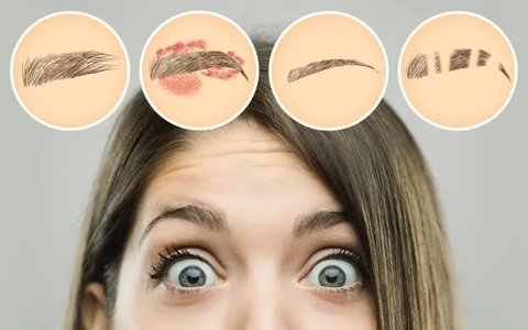 4 kiểu lông mày cảnh báo bệnh tật, nếu thấy mình có thì đừng bỏ qua