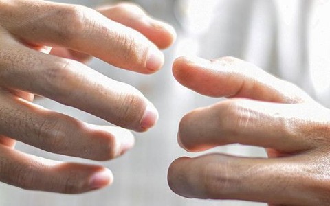 Bàn tay có thể dự báo bệnh tật: 4 dấu hiệu bất thường ở tay cảnh báo tim, gan suy yếu, ung thư ‘tìm đến’