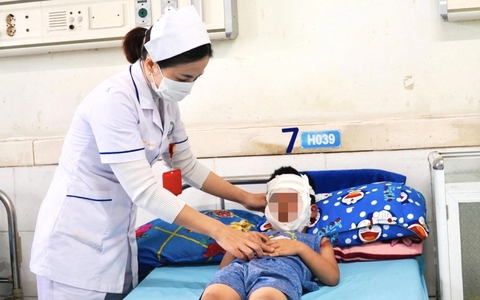 Bé trai 4 tuổi bị bỏng toàn mặt do bóng bay phát nổ