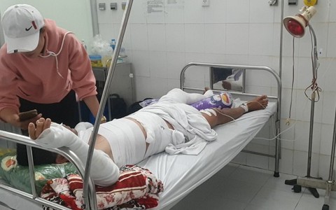 Ghe biển chuẩn bị ra khơi bất ngờ phát nổ làm ba người bị bỏng nặng