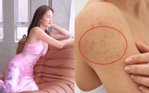 5 dòng sữa dưỡng thể giá từ 150k: Giải quyết nhanh gọn làn da sần sùi, thô ráp trong mùa hanh khô