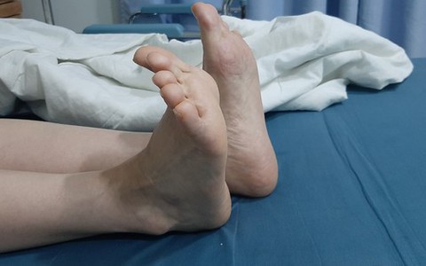 Nữ bệnh nhân đau đớn, chân trái dài thêm 4cm sau phẫu thuật khớp háng
