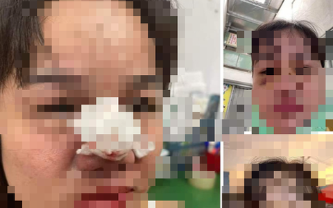 Người nổi tiếng kêu gọi từ thiện ở Quảng Nam bị bóc phốt ăn chặn tiền nói gì?