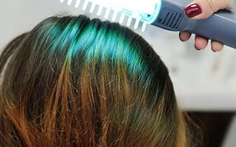Cấy tóc, mọc tóc, giảm mỡ bụng - máy lazer làm được hết: Chuyên gia nói gì?