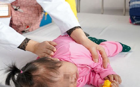 5 tiếng phẫu thuật cứu sống bé gái mắc bệnh tim, hẹp khí quản
