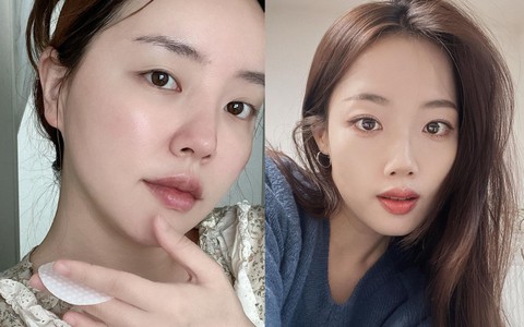 4 sản phẩm chăm sóc da bác sĩ không bao giờ dùng