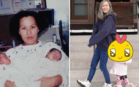 Cặp sinh đôi kỳ lạ nhất thế giới: Chào đời giống y đúc, ngoại hình lúc trưởng thành gây bất ngờ
