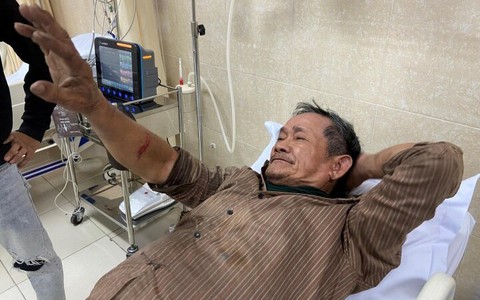 Thanh kim loại hàng chục kg rơi từ trên cao, trúng người đi đường ở Nha Trang