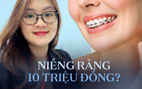 Cơn sốt "Niềng răng từ A đến Z giá rẻ dưới 10 triệu đồng", bác sĩ cảnh báo