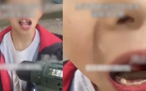 Bé trai 9 tuổi đau răng phát khóc, nào ngờ bố làm điều ai cũng sợ