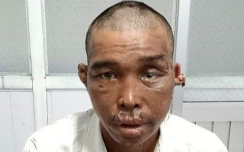 Ngư dân bị hành hạ dã man trên tàu cá giờ ra sao?