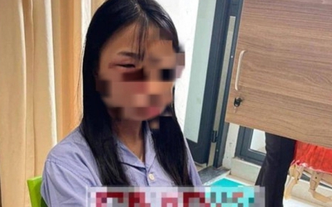 Giám định thương tích nữ sinh lớp 8 bị đánh hội đồng
