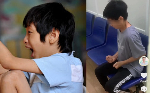 Nam thiếu niên bị Tic hỗn hợp đến suy kiệt sức khỏe, bác sĩ chỉ ra loạt dấu hiệu cảnh báo