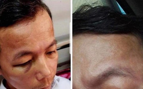 Vụ hiệu trưởng đánh hiệu phó nhập viện ở Quảng Bình: Cả hai cùng bị phạt tiền