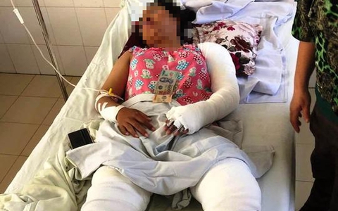 Mâu thuẫn, mẹ kế tẩm xăng đốt sách vở con riêng khiến 4 người bỏng nặng