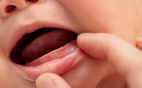 Trẻ thiếu canxi thường có 4 dấu hiệu, khuyến cáo cha mẹ làm ngay điều này để con cao lớn