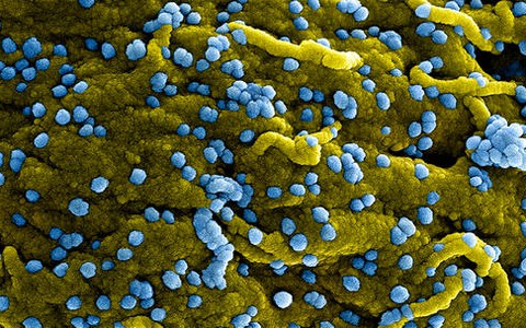 CDC Mỹ cảnh báo nguy cơ virus Marburg lây lan từ châu Phi